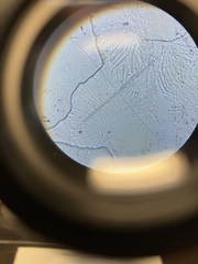 Orbilia xanthostigma