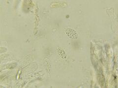 Macrotyphula contorta