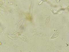 Macrotyphula contorta