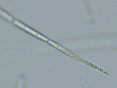 Tolypocladium capitatum