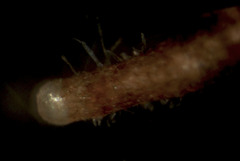 Acephala macrosclerotiorum