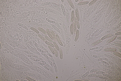 Thyronectria aurigera