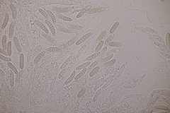 Thyronectria aurigera