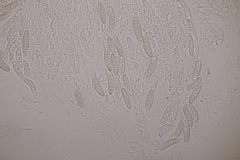 Thyronectria aurigera