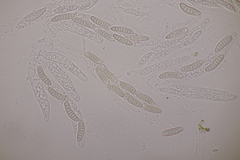 Thyronectria aurigera