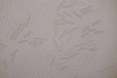 Thyronectria aurigera