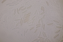 Thyronectria aurigera