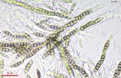 Lophiostoma