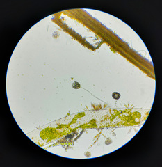 Vorticella campanula
