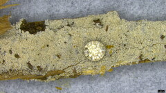 Hyphodontia