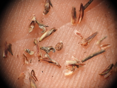 Schoenus ornithopodioides