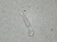 Gastrotricha