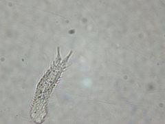 Gastrotricha