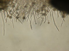 Pythium