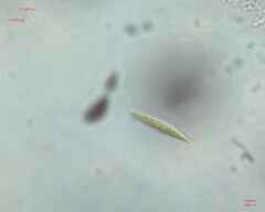 Chlorogonium