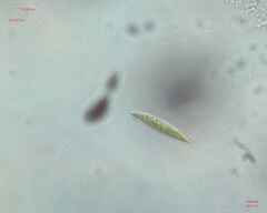 Chlorogonium