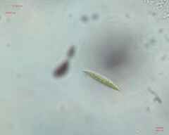 Chlorogonium