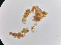 Trentepohlia umbrina