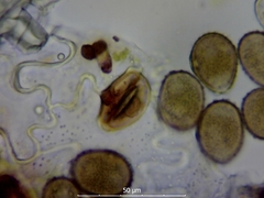 Uromyces viciae-fabae