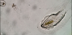 Peritromus tetramacronucleatus