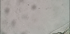 Peritromus tetramacronucleatus