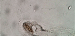 Peritromus tetramacronucleatus