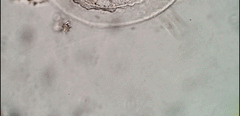 Peritromus tetramacronucleatus