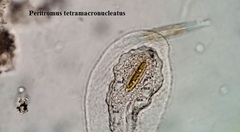 Peritromus tetramacronucleatus