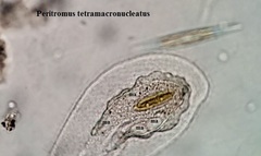 Peritromus tetramacronucleatus