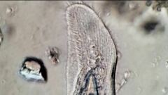 Peritromus tetramacronucleatus