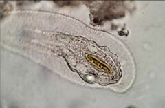 Peritromus tetramacronucleatus