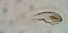 Peritromus tetramacronucleatus