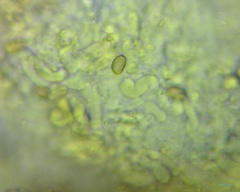 Pyrrhulomyces astragalinus