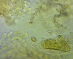 Pyrrhulomyces astragalinus