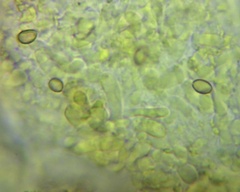 Pyrrhulomyces astragalinus