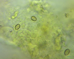 Pyrrhulomyces astragalinus
