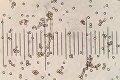 Tulostoma cretaceum