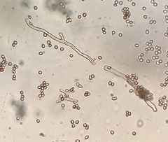 Tulostoma cretaceum