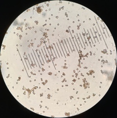 Tulostoma cretaceum