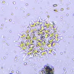 Pseudopediastrum