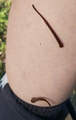 Chtonobdella limbata