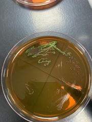 Escherichia coli