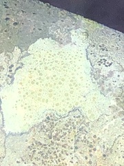 Lecanora strobilina