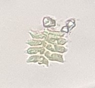 Scenedesmaceae
