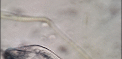 Bothrostoma undulans