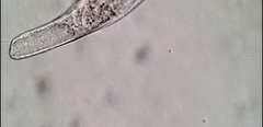 Bothrostoma undulans