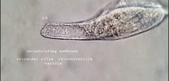 Bothrostoma undulans