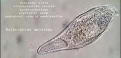 Bothrostoma undulans
