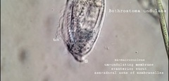 Bothrostoma undulans
