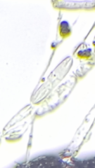 Coprinopsis mitrispora